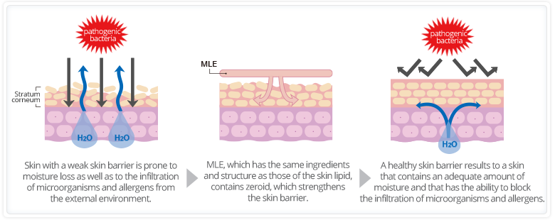 step1:Skin with a weak skin barrier is prone to moisture loss as well as to the infiltration of microorganisms and allergens from the external environment./step2:MLE, which has the same compounds and structure as those of the skin lipid, contains zeroid, which strengthens the skin barrier./step3:A healthy skin barrier results to a skin that contains an adequate amount of moisture and that has the ability to block the infiltration of microorganisms and allergens.